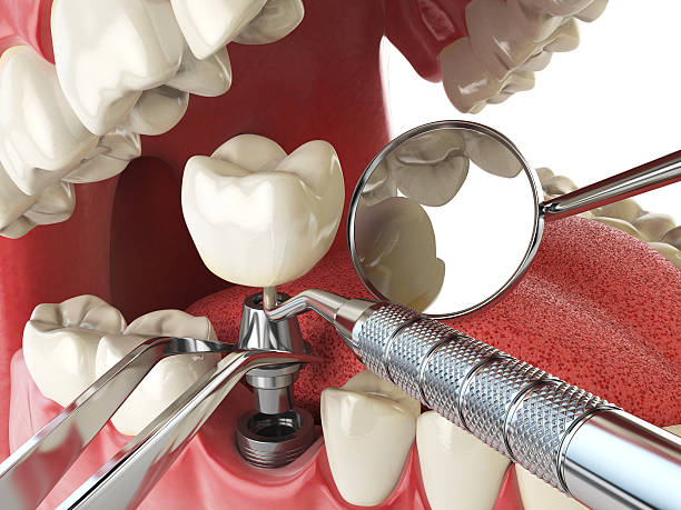 Best Emergency Orthodontic Repairs in Rensselaer, IN